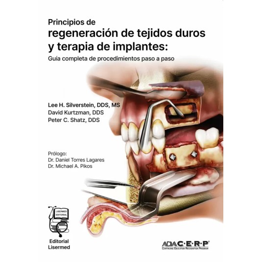 PRINCIPIOS DE REGENERACIÓN DE TEJIDOS DUROS Y TERAPIA DE IMPLANTES