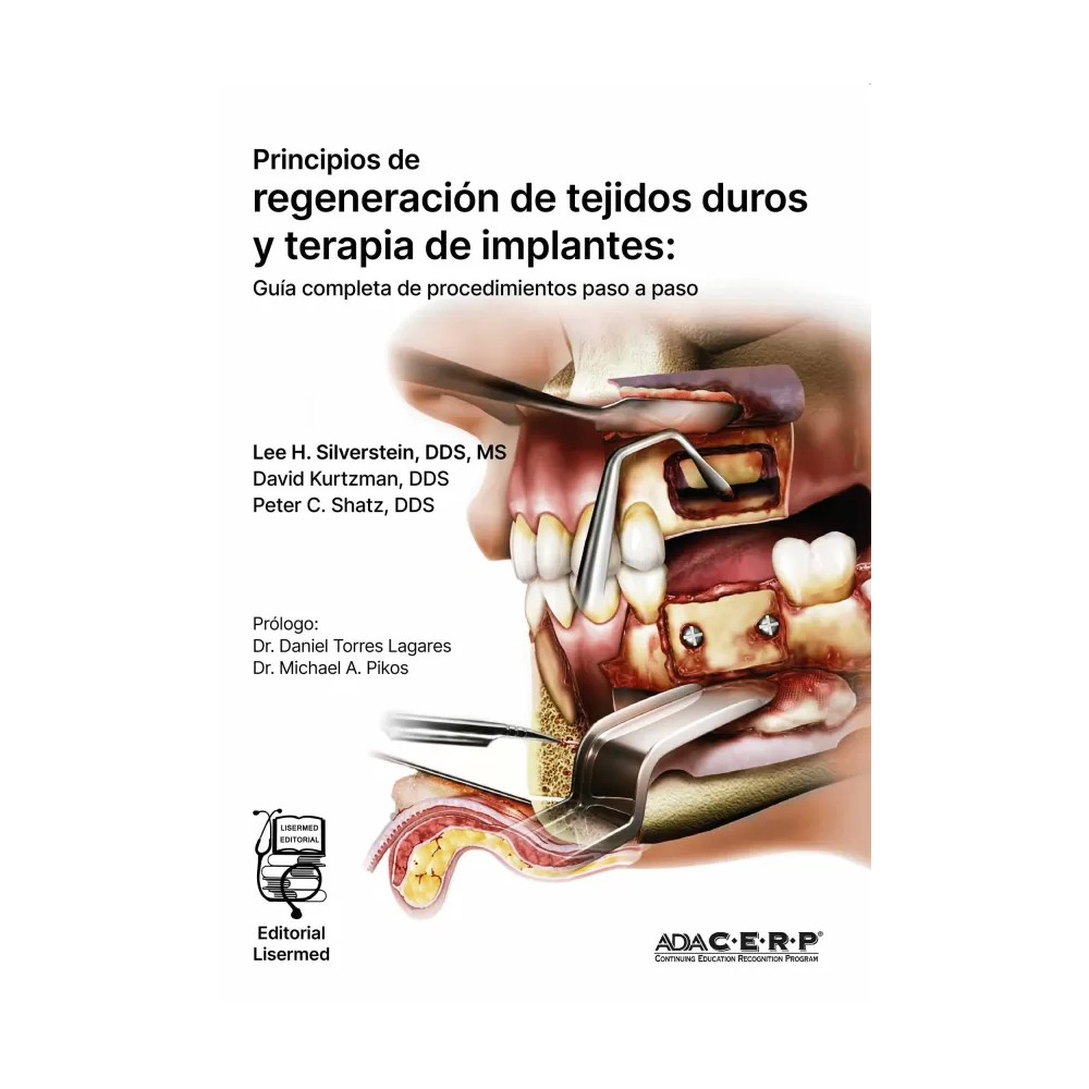 PRINCIPIOS DE REGENERACIÓN DE TEJIDOS DUROS Y TERAPIA DE IMPLANTES