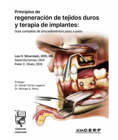 PRINCIPIOS DE REGENERACIÓN DE TEJIDOS DUROS Y TERAPIA DE IMPLANTES