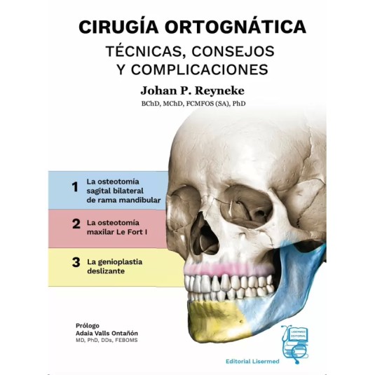 CIRUGÍA ORTOGNÁTICA