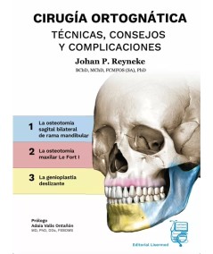 CIRUGÍA ORTOGNÁTICA